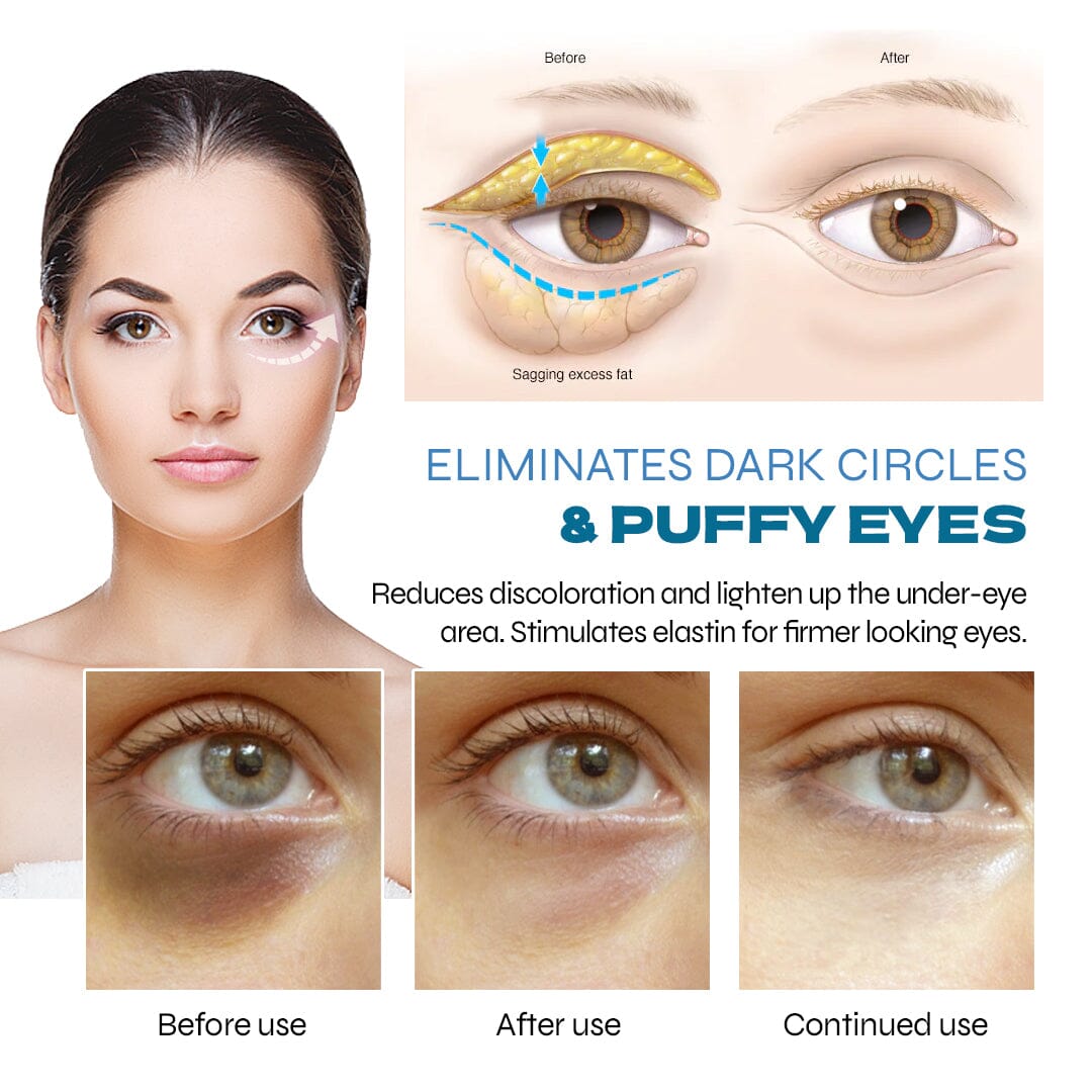 EyeJuvenate Collagen Niacinamide Eye Cream